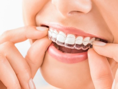 Clinica Dental Ites Dental Getafe