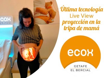 Ecografía proyectada en tripa mama - Ecografias 4D 5D Ecox Getafe el Bercial LomejordeGetafe