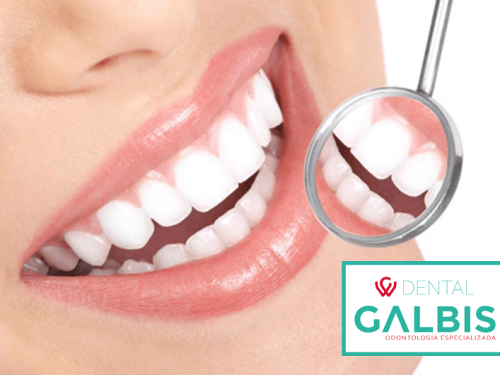 Dental Galbis